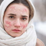 Nima Knows:
 How To Repair Skin Barrier & Stay Moisturised Through Winter