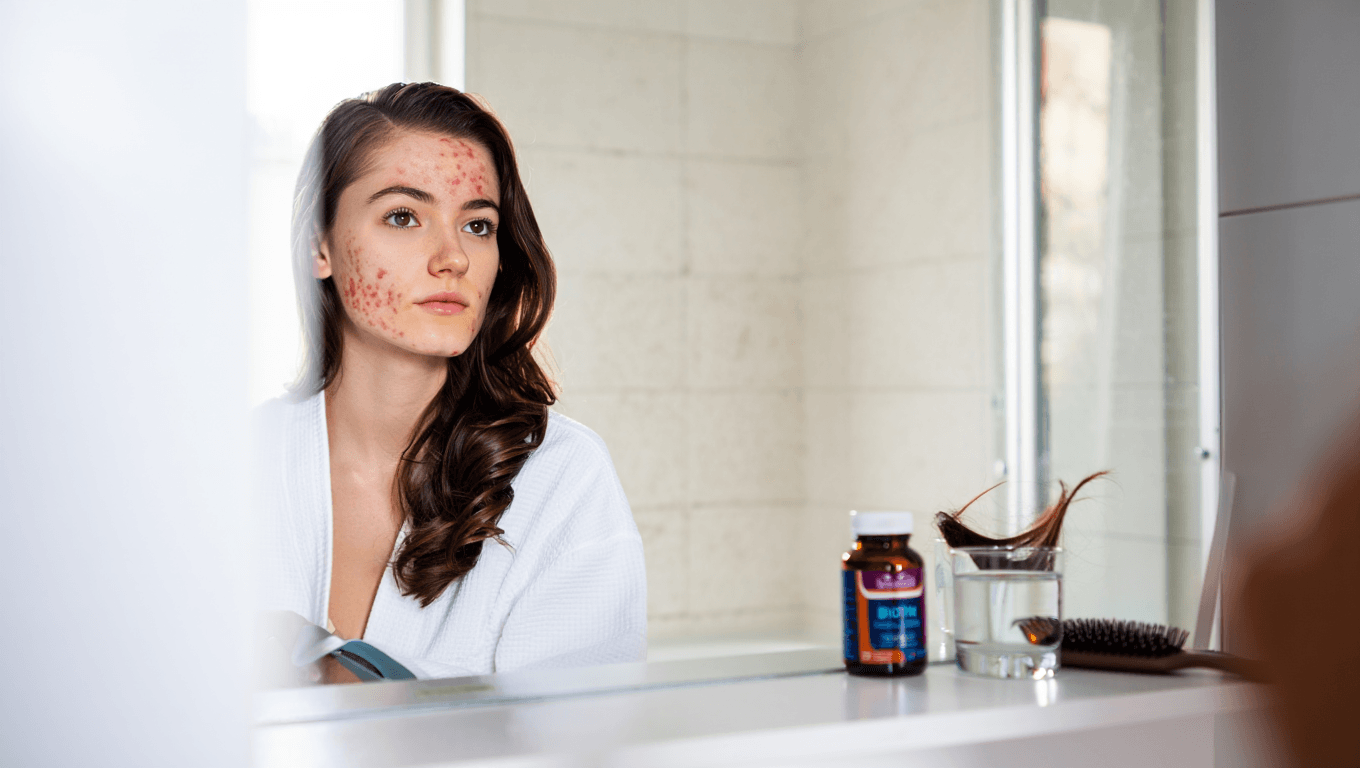 Nima Knows:
 Does Biotin Make Your Skin Break Out?