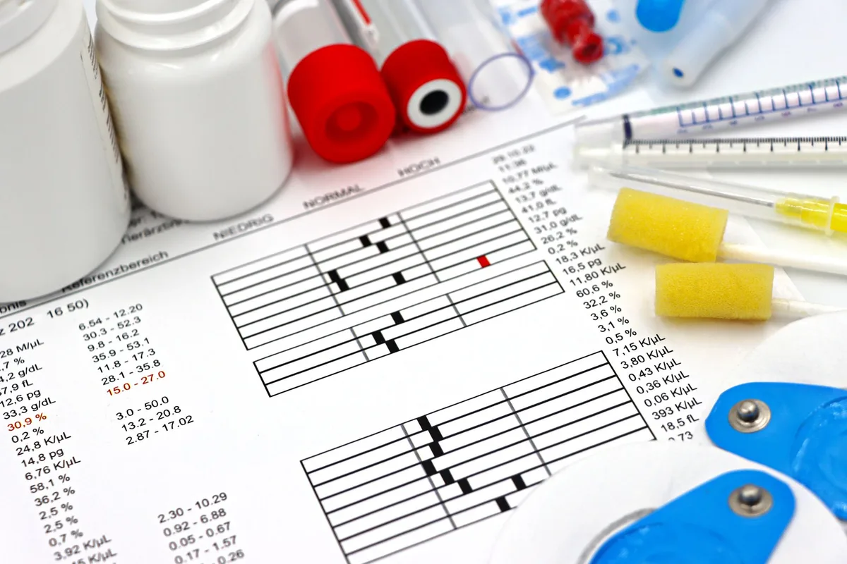 Résultats d'analyses sanguines affichés sur écran de laboratoire médical