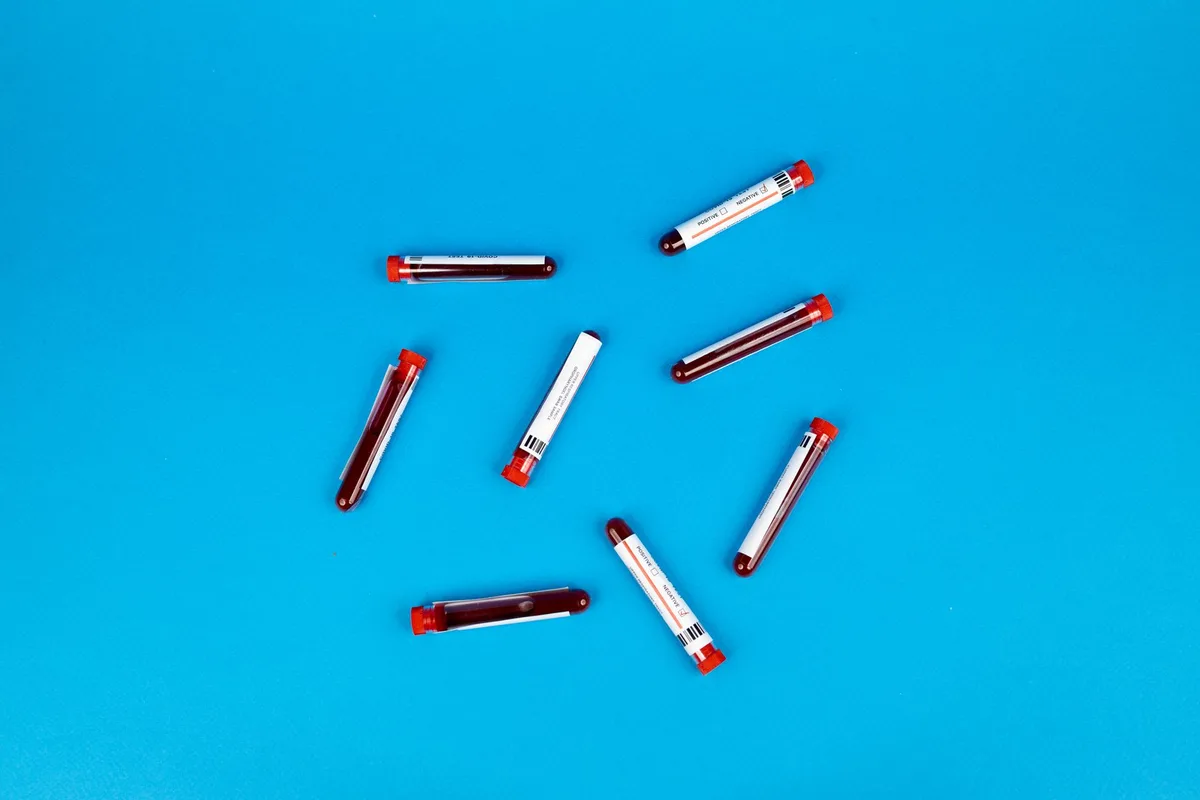 Capsule de supplément et résultats d'analyse lipidique sur un bureau médical