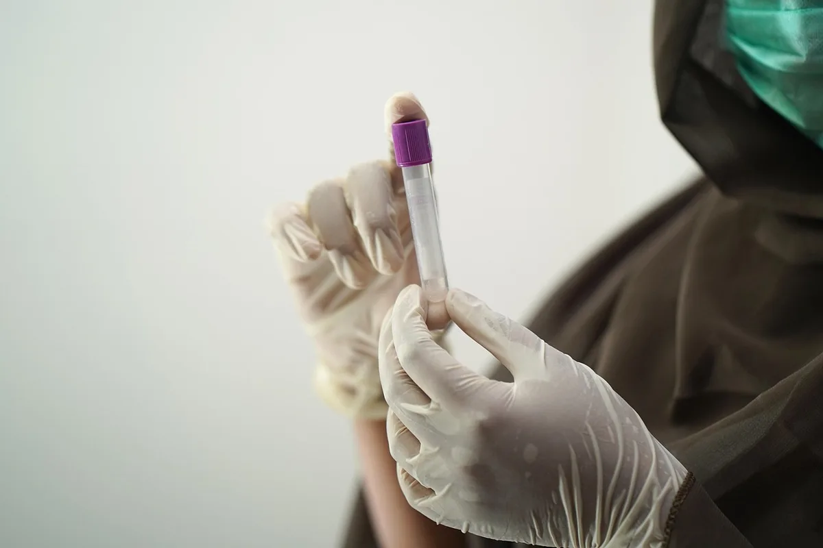 Prélèvement sanguin en laboratoire pour tester les niveaux de vitamine B12