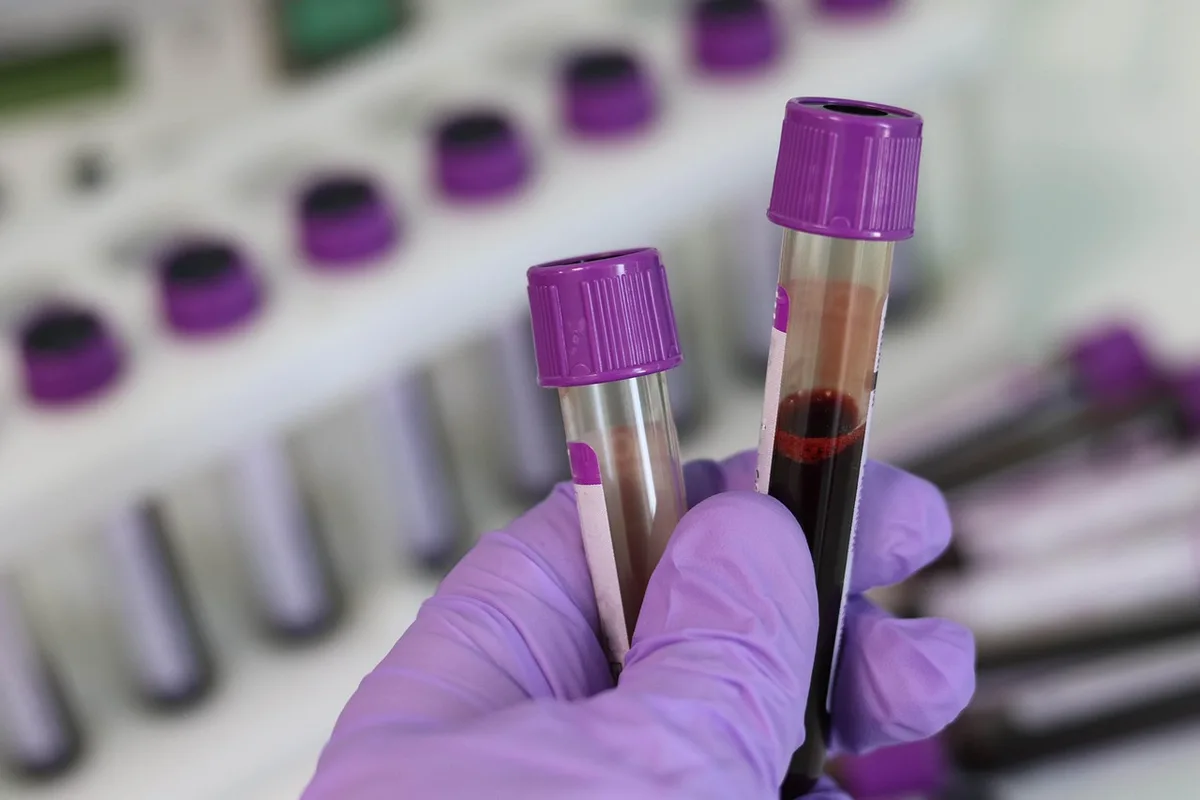 Résultats d'analyses sanguines et mains d'un professionnel de santé expliquant
