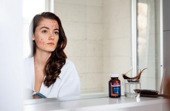 Biotine et acné : la biotine provoque-t-elle des boutons ?