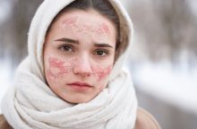 Comment réparer la barrière cutanée et garder la peau hydratée en hiver ?