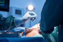 Dénervation rénale pour l&rsquo;hypertension résistante : principe, efficacité et risques
