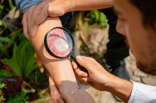 Dix antifongiques naturels efficaces et validés par des études scientifiques