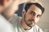 Top 3 solutions pour arrêter la perte des cheveux chez les hommes