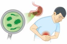 Quels sont les symptômes d’une infection d’Helicobacter pylori ?