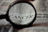 Immunothérapie : que faut-il savoir sur ce traitement contre le cancer ?