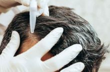 L&rsquo;efficacité prouvée de l&rsquo;acide hyaluronique sur nos cheveux et ongles