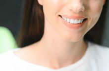 Avis des utilisateurs sur le kit de blanchiment dentaire Californian Smiles