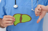 Peut-on vivre longtemps avec une cirrhose du foie ? La réponse des spécialistes