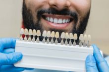 Quels sont les critères pris en compte pour bénéficier d&rsquo;une prothèse dentaire 100 % remboursée ?