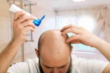 Quelles sont les causes les plus fréquentes des pertes de cheveux ?