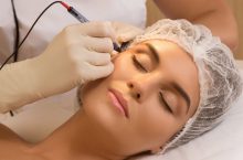 Témoignage sur la procédure médicale de la Thermocoagulation